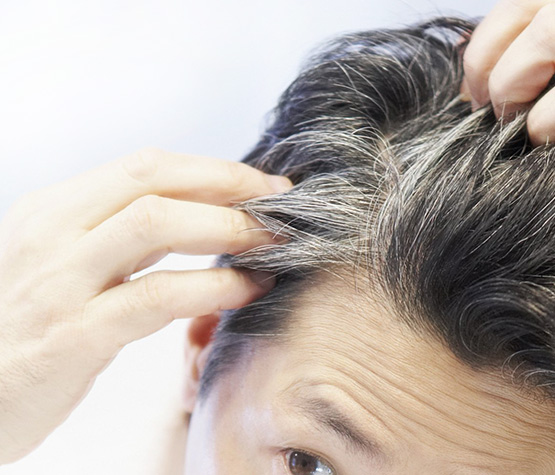 does glutathione make hair grey Glutathione: The Guardian Of Hair Color And Health main image 1